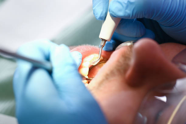 Best Emergency Denture Repair in Lyndon, KS