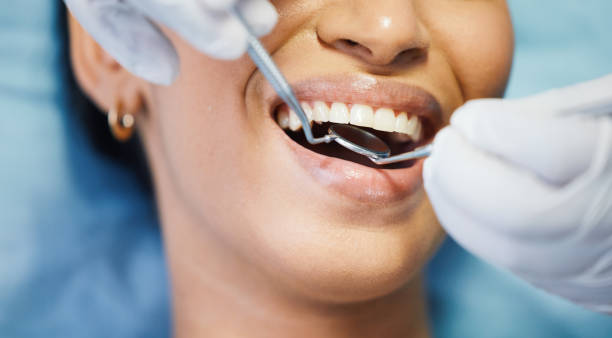Best Emergency Dental Care for Broken or Chipped Teeth in Lyndon, KS