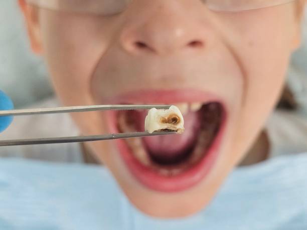 Best After-Hours Dental Trauma Care in Lyndon, KS